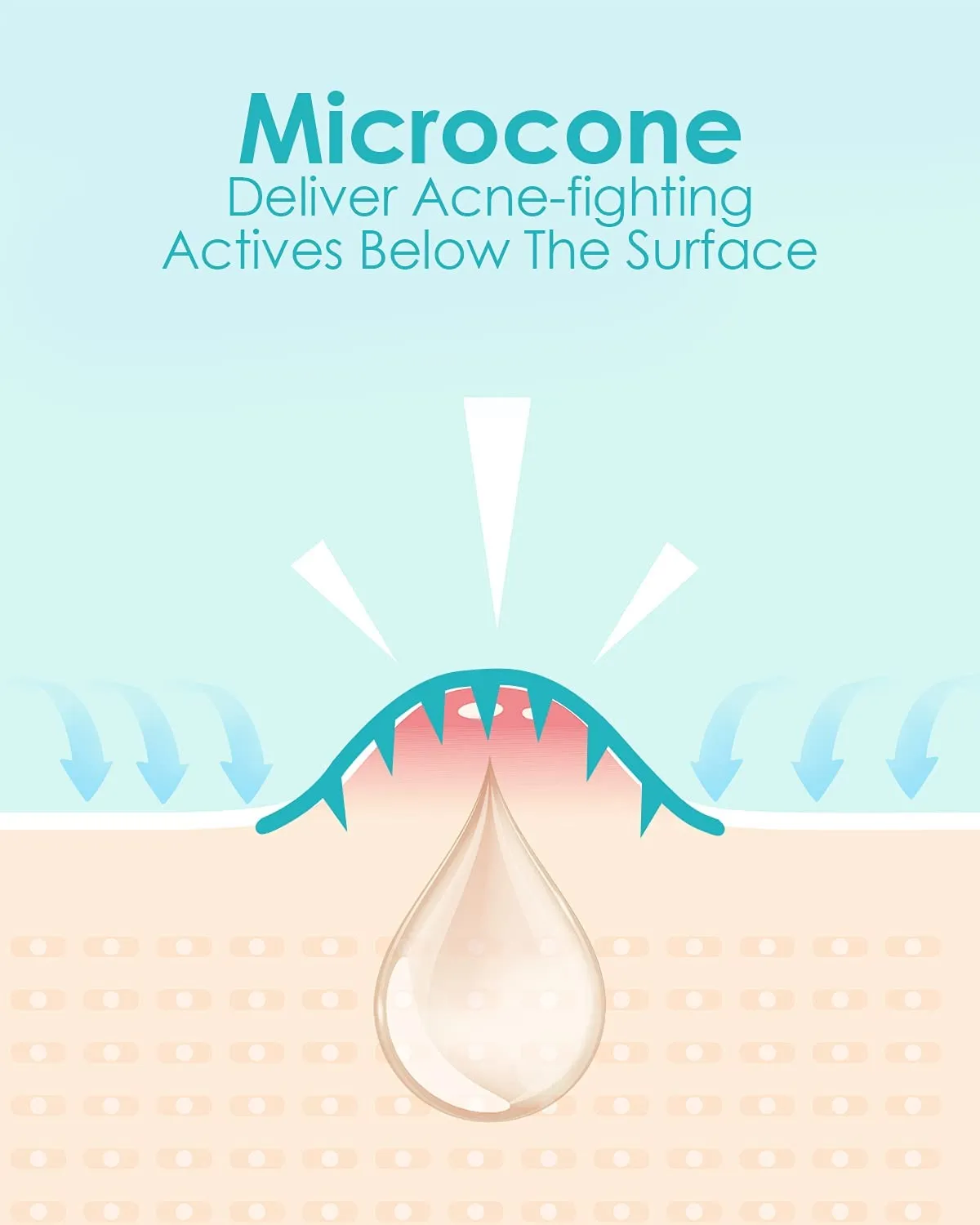  1HEROLABS Microdart Acne Patch - Hyaluronate, Salicylic Acid, Vitamin C, Microdart Pimple Patch for Deep, Early Stage and Hidden Pimples (36 Patches - 2 Pack)