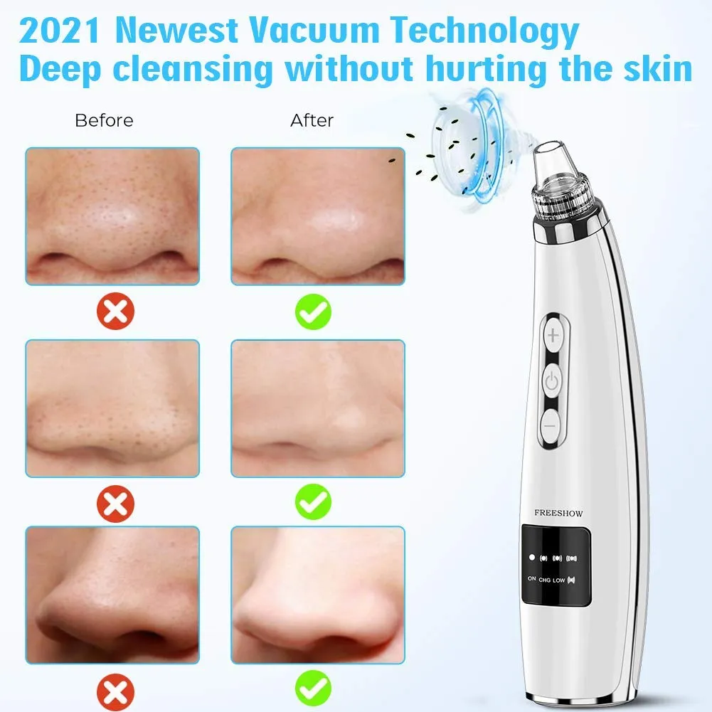 2021 Newest Blackhead Remover Vacuum Pore Cleaner, Electric Acne Comedone Whitehead Extractor with 5 Suction Power & 5 Probes, USB Rechargeable, Blackhead Pore Vacuum for Women & Men Black