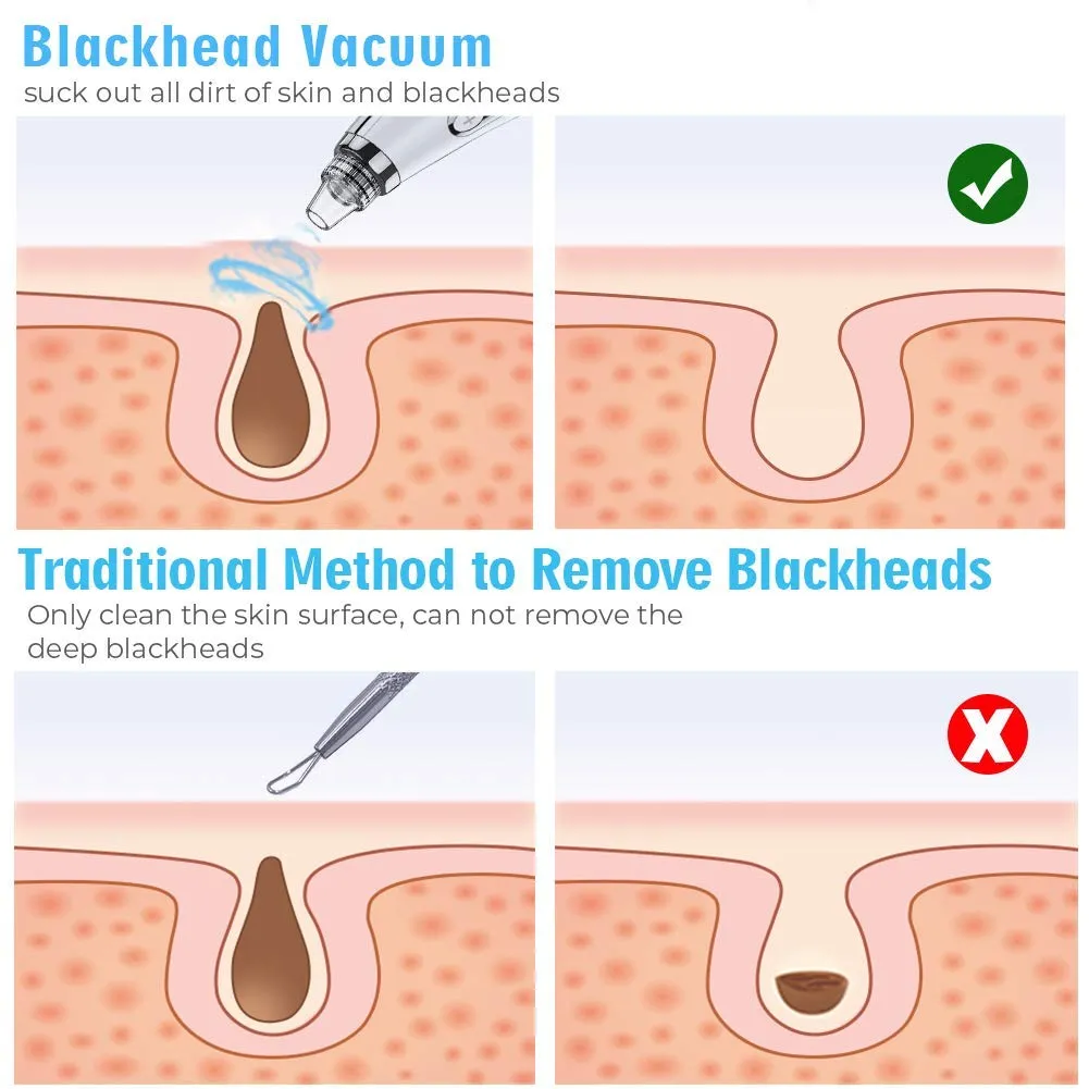 2021 Newest Blackhead Remover Vacuum Pore Cleaner, Electric Acne Comedone Whitehead Extractor with 5 Suction Power & 5 Probes, USB Rechargeable, Blackhead Pore Vacuum for Women & Men Black