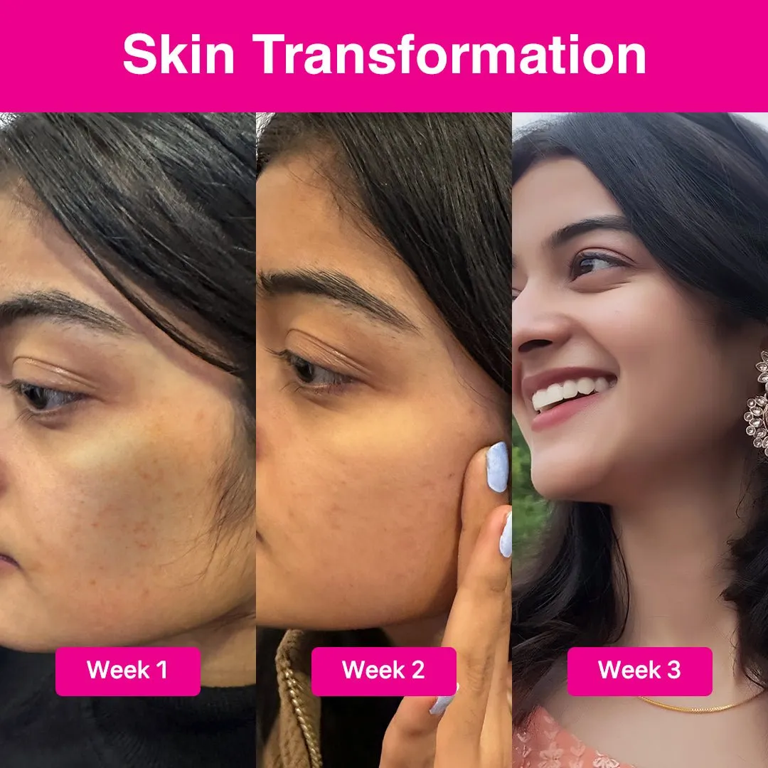 ABP-33% Strong Exfoliating Peeling Solution