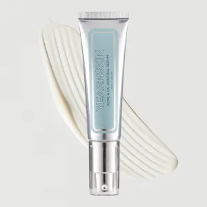 Acne and Oil Control Serum | 30ml