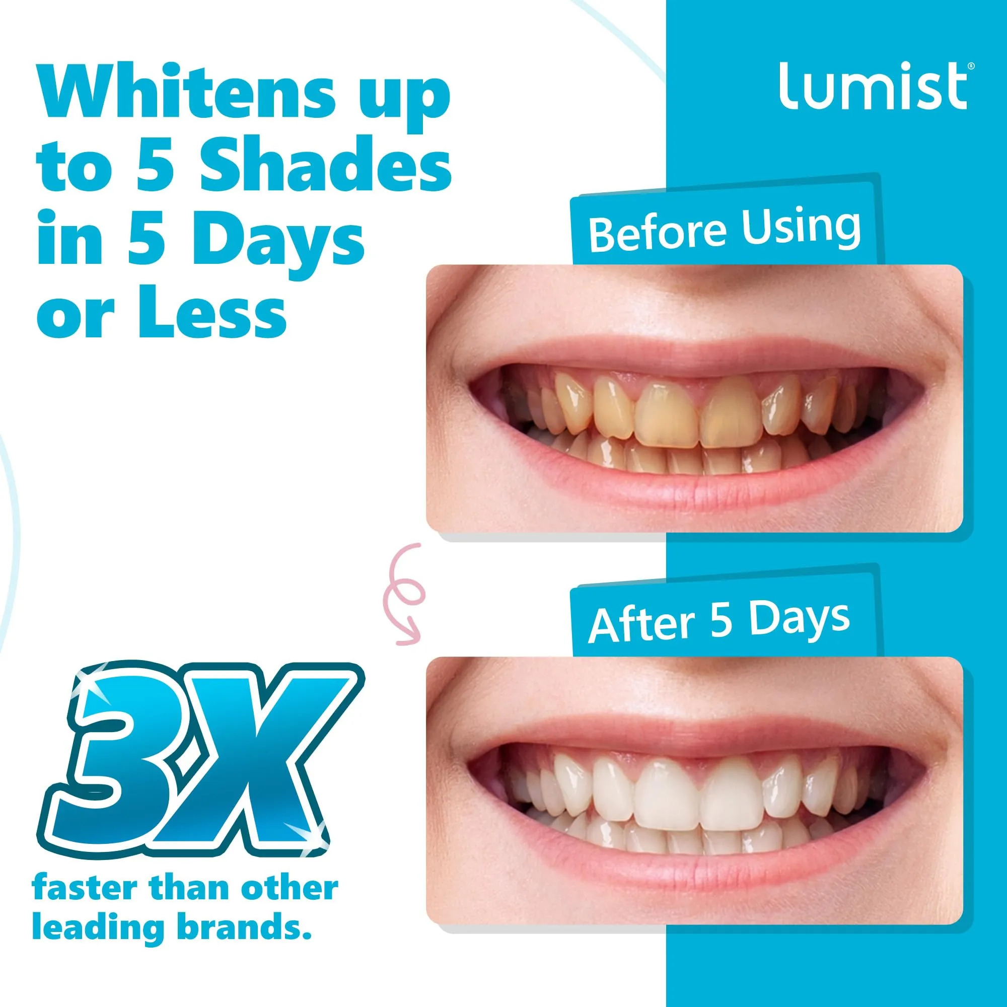 Advanced Teeth Whitening Strips – Pack of 10 (5 Treatments) - 5 Shades Brighter in 5 Days - Mint Flavored with Enamel Safe Comfort Fit Technology - Teeth Whitening Kit for Sensitive Teeth 10 Count (Pack of 1)