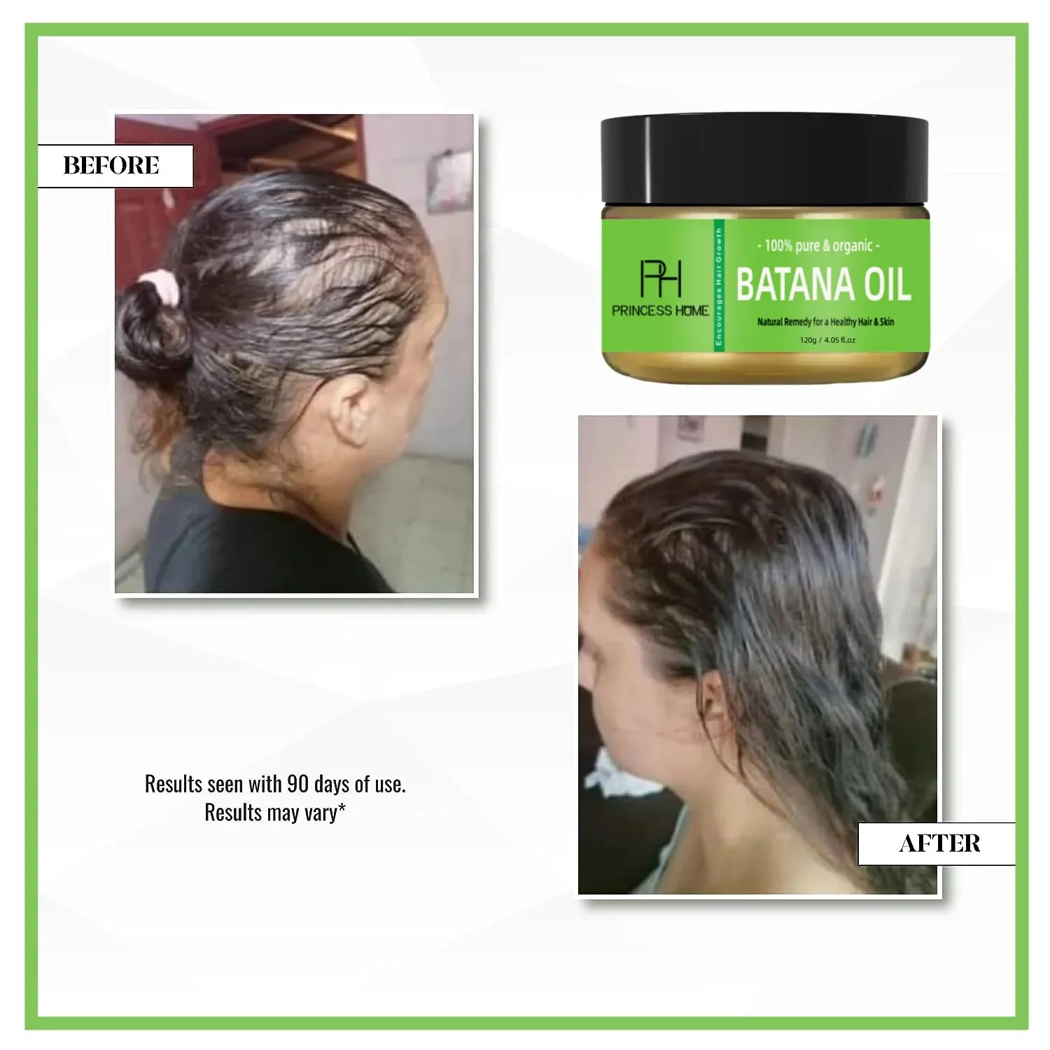 Batana Oil Hair Growth Serum with Rosemary - Thickening, Repairing, and Nourishing Formula
