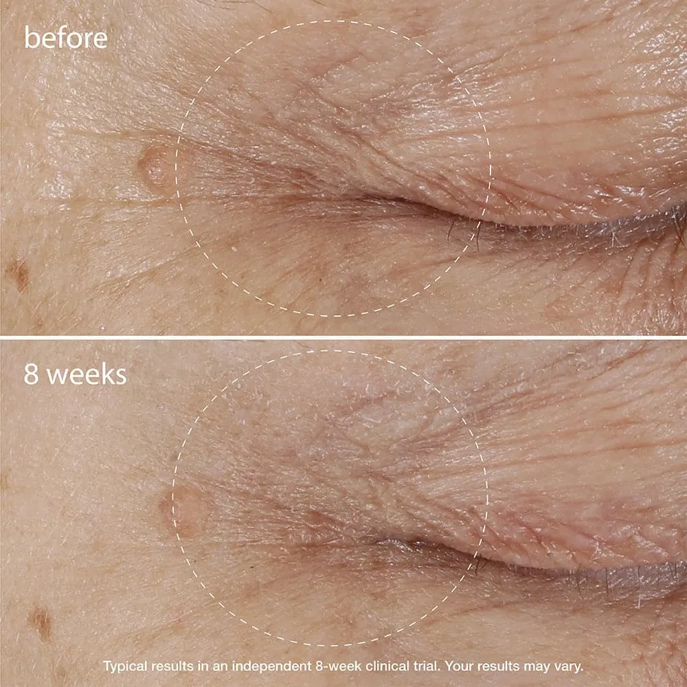 Biolumin-C Eye Serum Brightening Vitamin C Serum