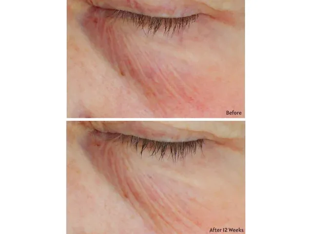 C  Brightening Eye Complex