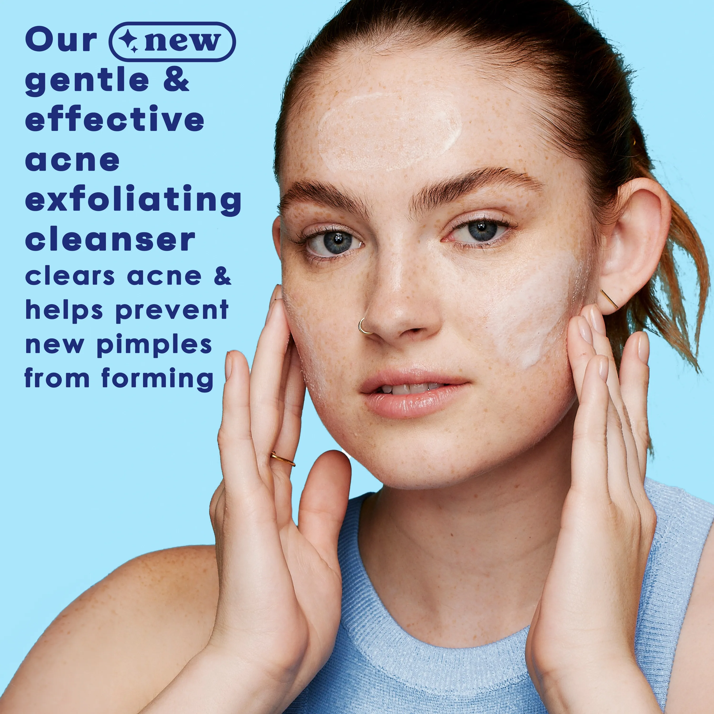 CLEAN & CLEAR acne exfoliating cleanser salicylic acid acne treatment with aloe mint & naturally derived beads غسول البشرة لعلاج الحبوب من كلين اند كلير