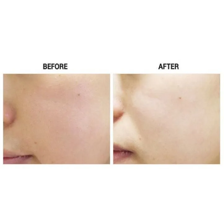 Crazy Skin Crazy Lifting Mask (5EA)
