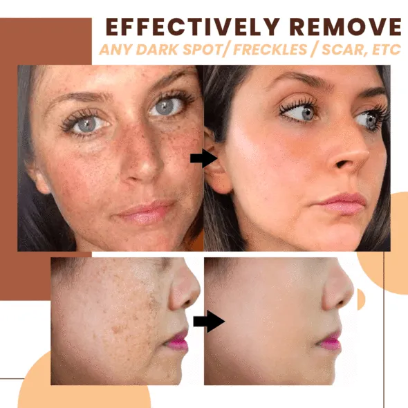 Dark Spot Corrector Serum