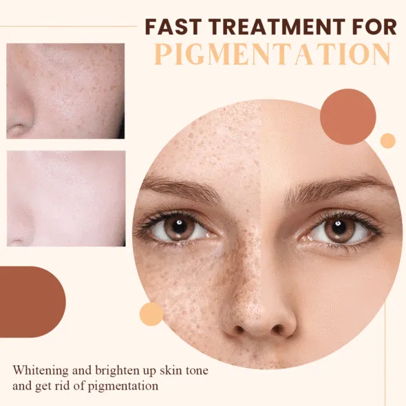 Dark Spot Corrector Serum