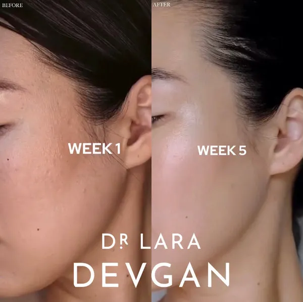 Dr. Lara Devgan Retinol   Bakuchiol Serum 2.5x