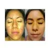 Dual Acne Serum | 1 fl oz
