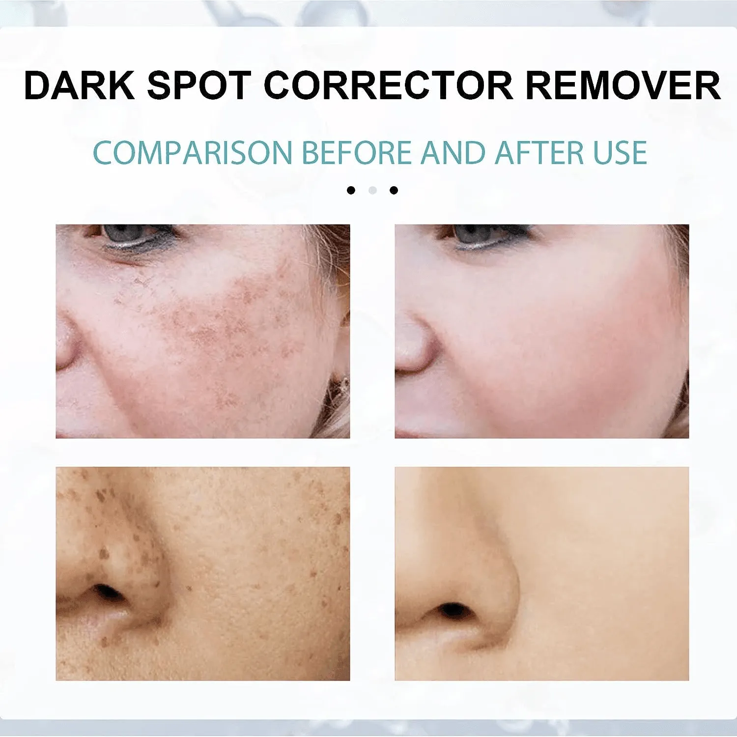 EELHOE Dark Spot Corrector - 30g