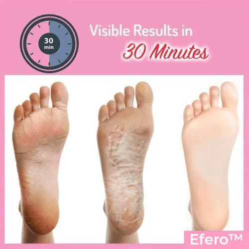 EFERO EXFOLIATING FOOT MASK