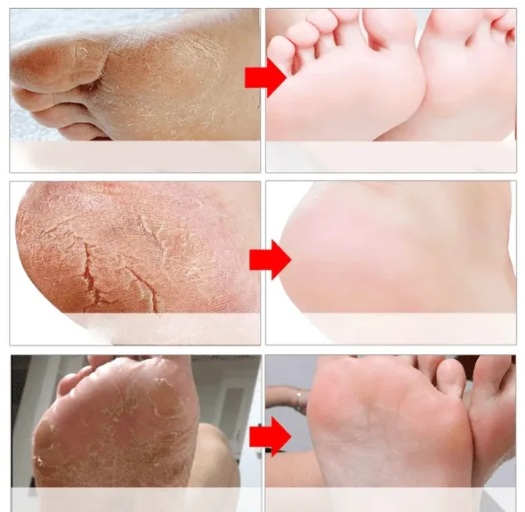 EFERO EXFOLIATING FOOT MASK