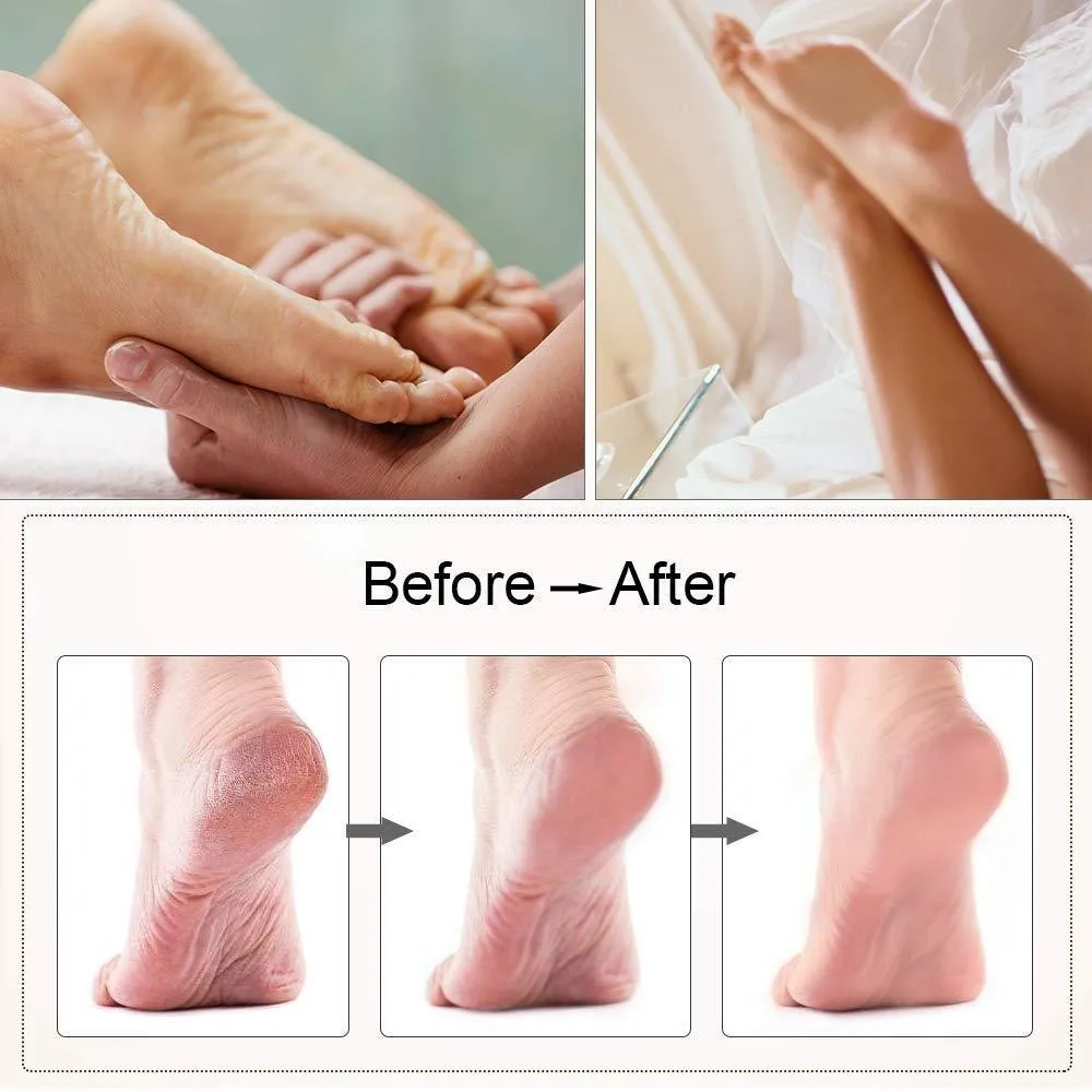 Electric USB Rechargeable Foot Grinder Heel File Grinding Exfoliator
