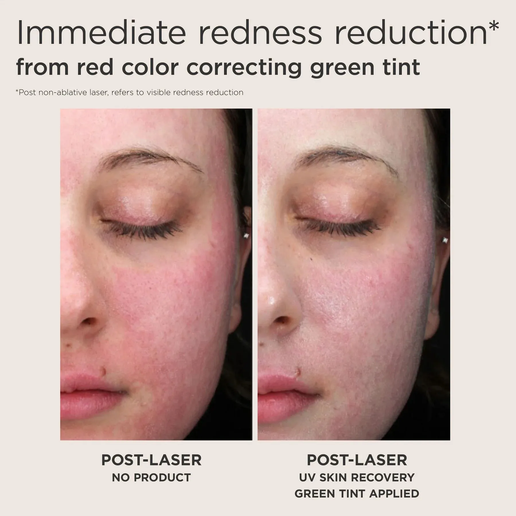 Elta MD UV Skin Recovery Red Color Correcting Green Tint SPF 50