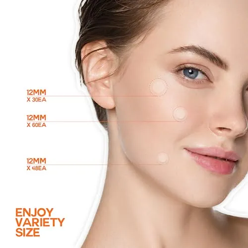Epielle Over-Zit Acne Clear Patches | Ultimate Hydrocolloid Solution | 138 Acne and Blemish Patches for Clear Skin