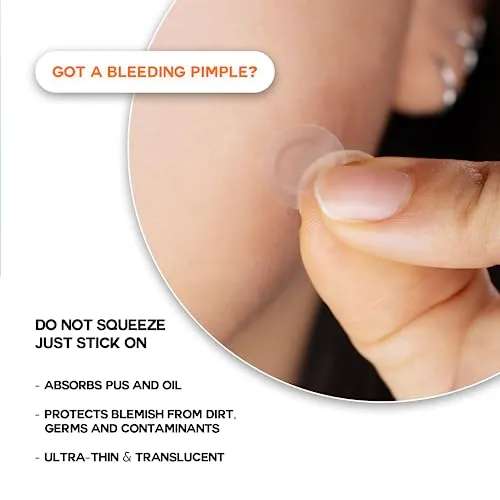 Epielle Over-Zit Acne Clear Patches | Ultimate Hydrocolloid Solution | 138 Acne and Blemish Patches for Clear Skin