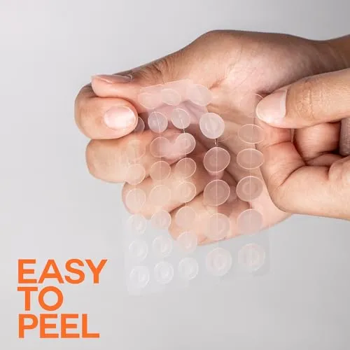 Epielle Over-Zit Acne Clear Patches | Ultimate Hydrocolloid Solution | 138 Acne and Blemish Patches for Clear Skin