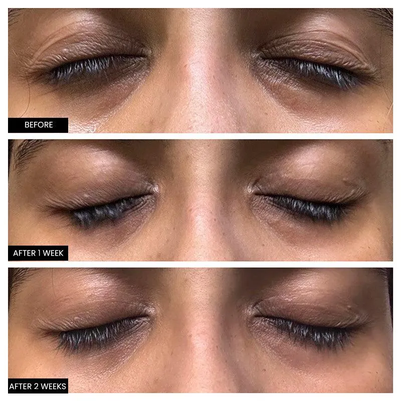 Eye Serum