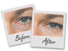 Eyelastin® - New Improved Formulation