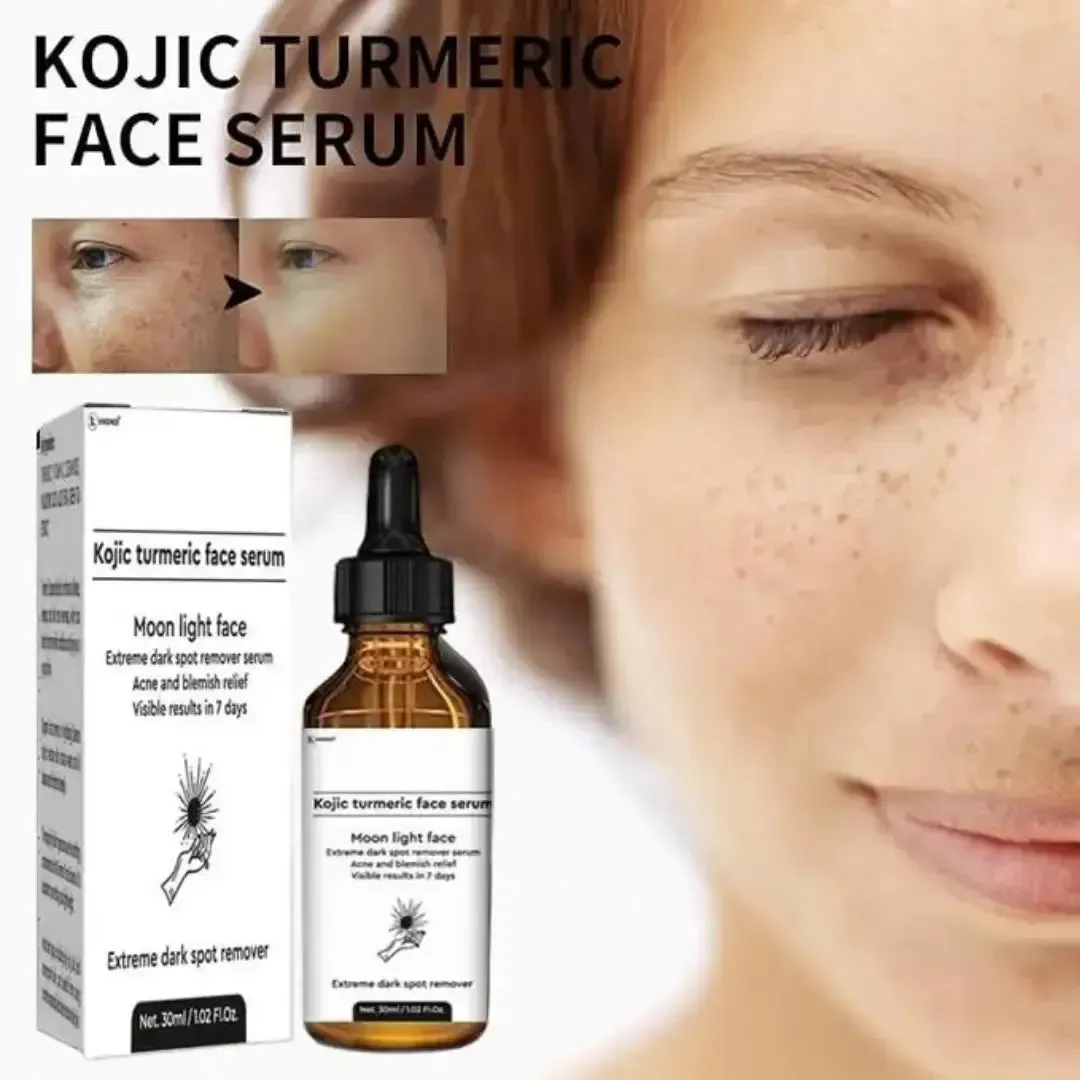 Kojic Acid Serum Turmeric Dark Spot Corrector Serum (Pack of 1)