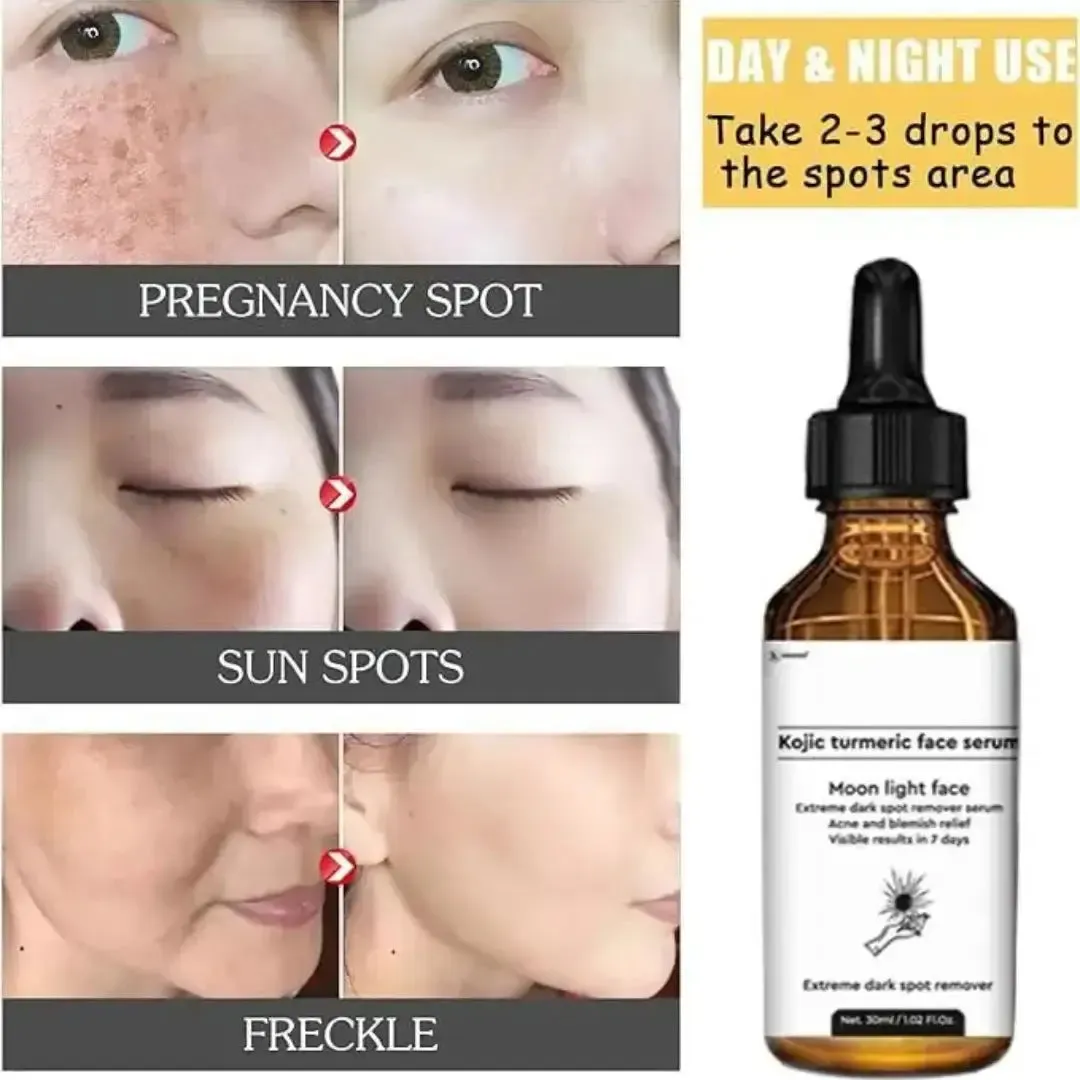 Kojic Acid Serum Turmeric Dark Spot Corrector Serum (Pack of 1)