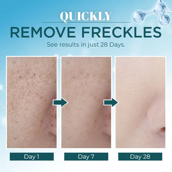 LANTHOME™ Dark Spot Corrector Remover