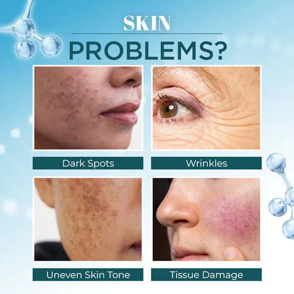 LANTHOME™ Dark Spot Corrector Remover