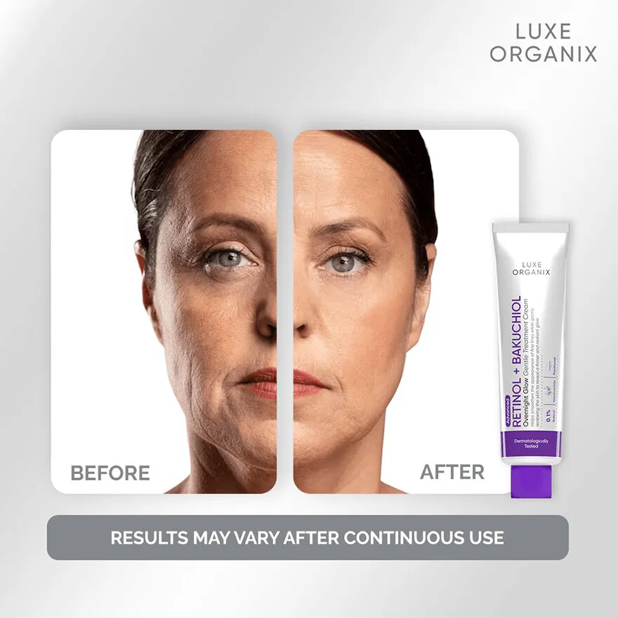 Luxe Organix Retinol   Bakuchiol Overnight Glow Gentle Treatment Cream - 30g