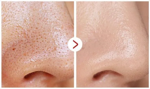 [MEDI-PEEL] Red Lacto Collagen Cleansing Balm to Oil 100ml