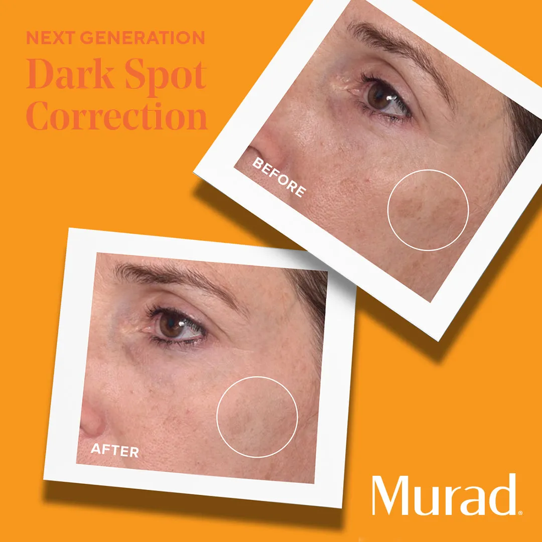 Murad Environmental Shield Rapid Dark Spot Correcting Serum