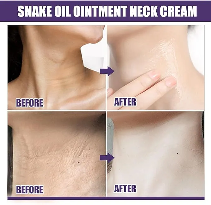 Neck Creams for Tightening and Wrinkles,Neck Firming Cream,Anti Wrinkle & Lifting Neck Lines,Nourishing Neck Tightening Cream,Sagging Neck Cream,Neck and Chest Firming Cream,Double Chin-Easy to Use