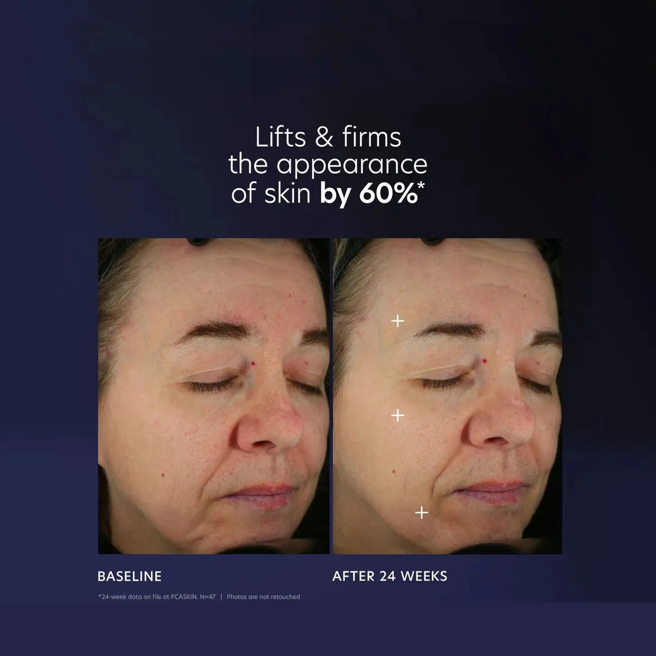 PCA Pro-Max Age Renewal
