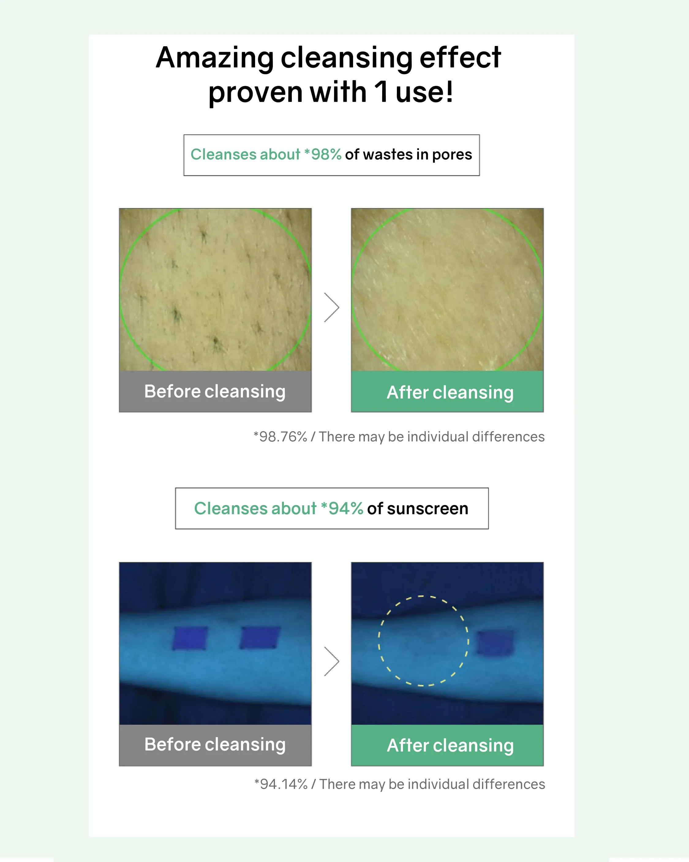 [PROMO] Bonabella Teatree Moist Soothing Cleanser