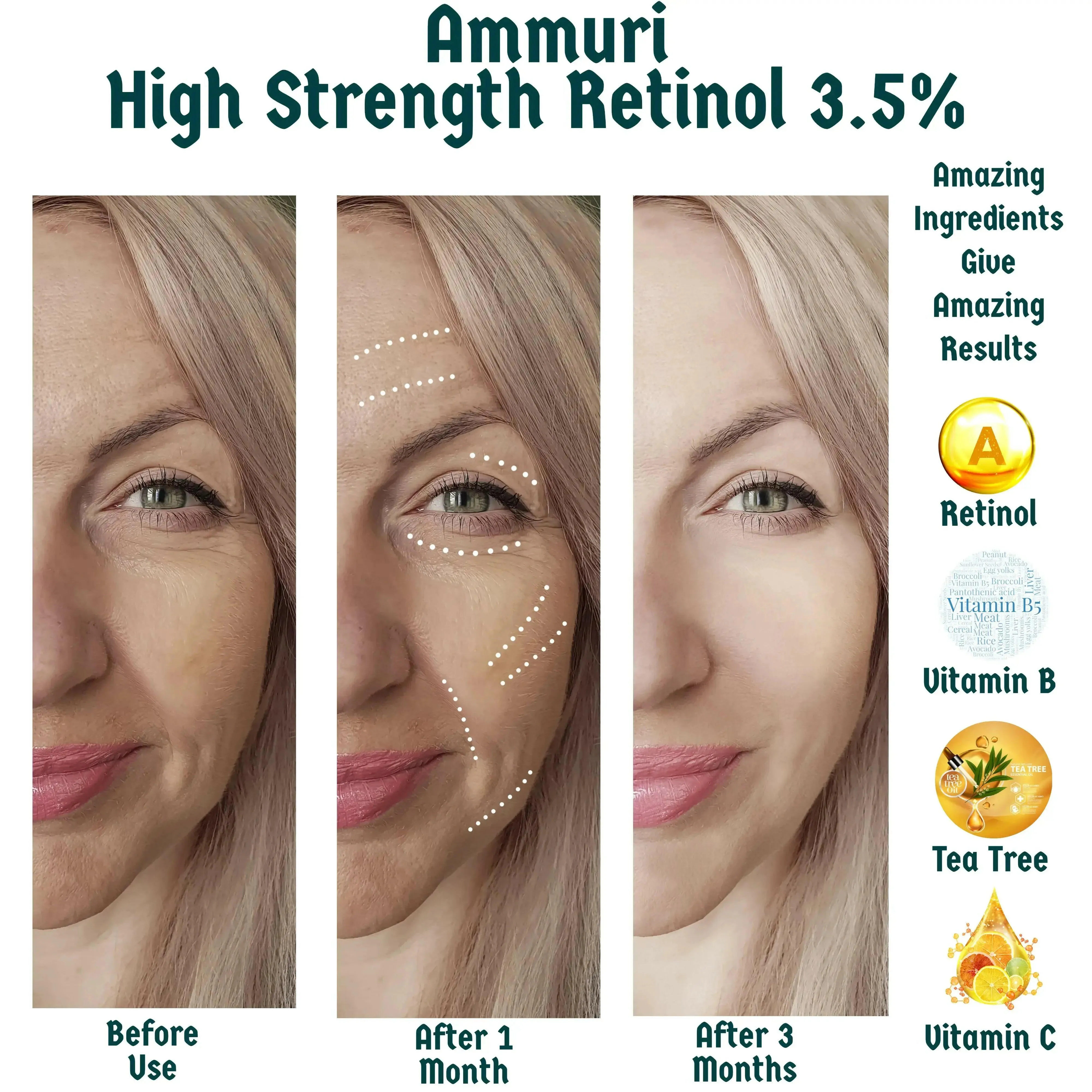 Retinol Serum 3.5% Retinol Anti Aging Face Serum