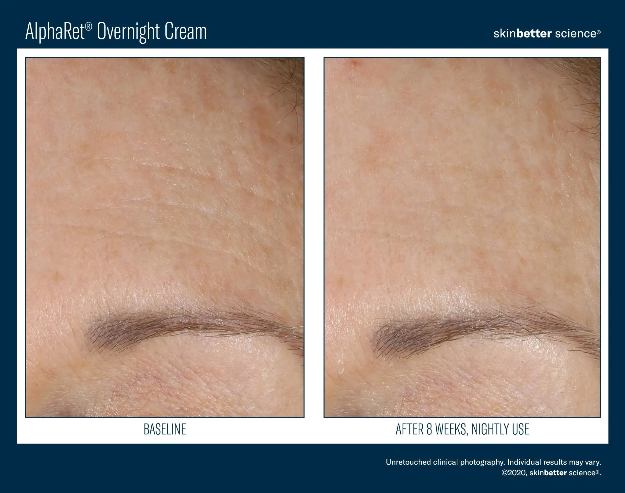 SKINBETTER Intensive AlphaRet Overnight Cream