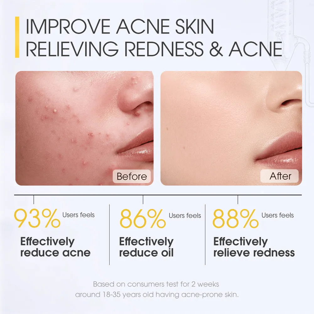 Skinever Salicylic Acid Acne Treatment Ice Sleep Masque - 75ml