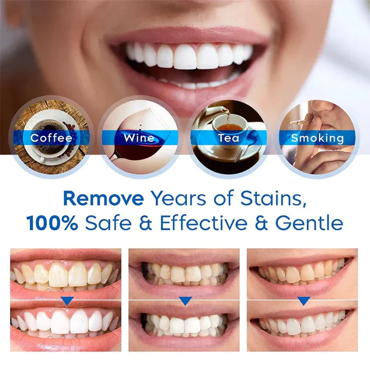 Teeth Whitening Pens