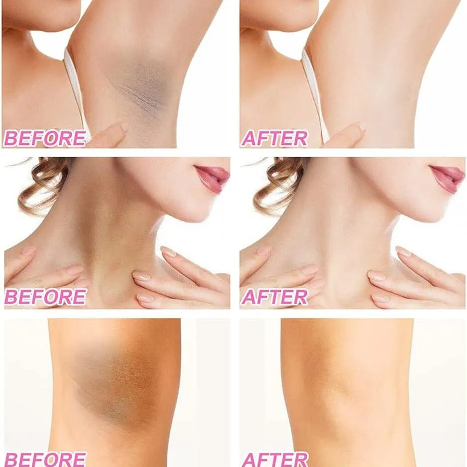 Underarm Skin Whitening Cream