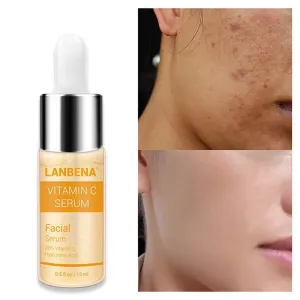 Vitamin C Whitening Face Serum